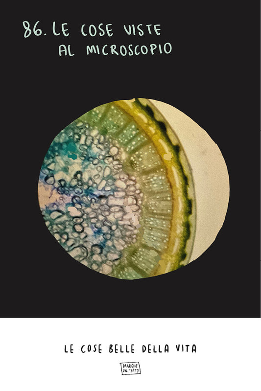 Le cose belle della vita - 86. Le cose viste al microscopio